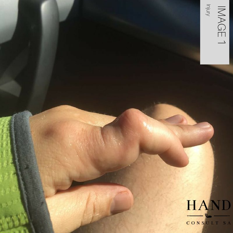 Hockey Injury